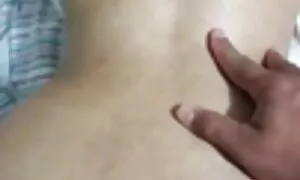 गुदद्वारासंबंधीचा pr ...