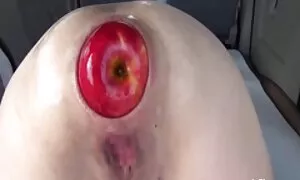 anal fisting चरम xxx ...