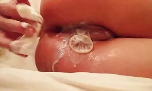 एचडी मध्ये शुक्राणू  ...